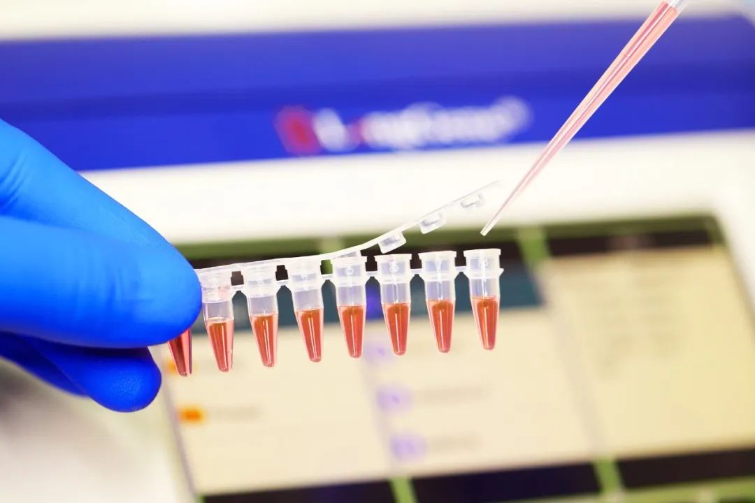 PCR/qPCR පරිභෝජන ද්‍රව්‍ය තෝරා ගන්නේ කෙසේද?